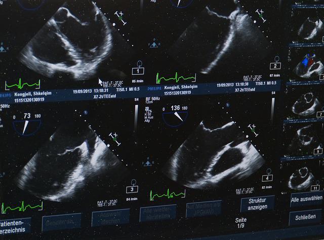 Badanie ultrasonograficzne, czyli USG – jak wygląda i kiedy warto z niego skorzystać?